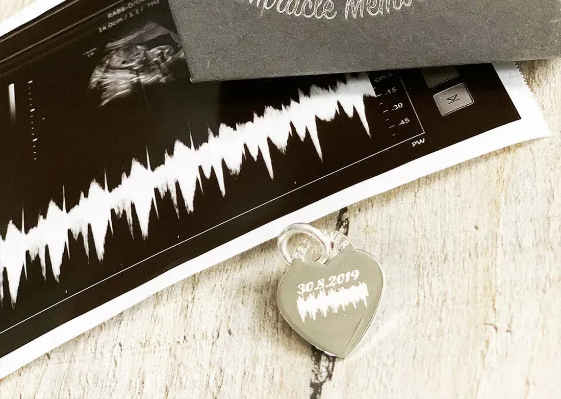 Pregnancy keepsake services